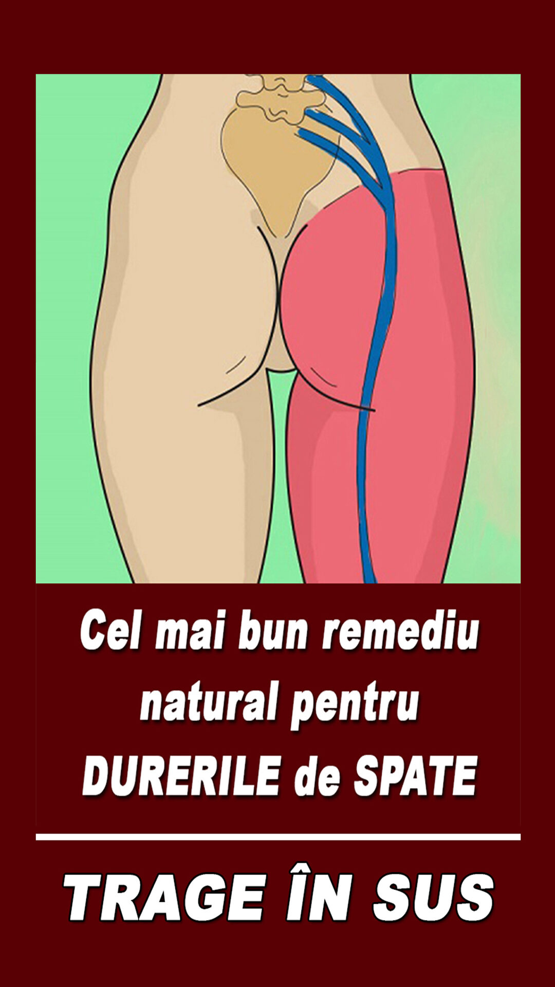 Cel Mai Bun Remediu Pentru Durerile Cauzate De Nervul Sciatic